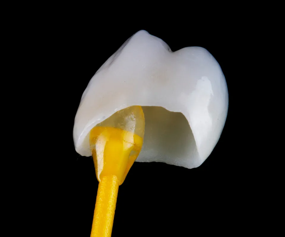 Dental Crowns