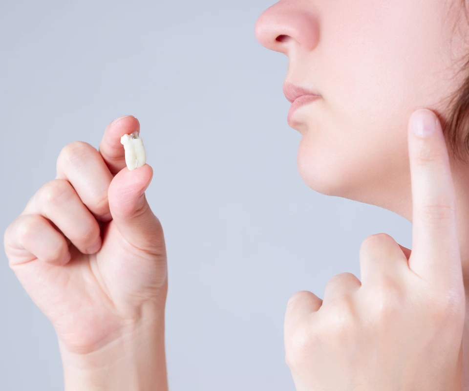 Emergency Wisdom Tooth Extraction