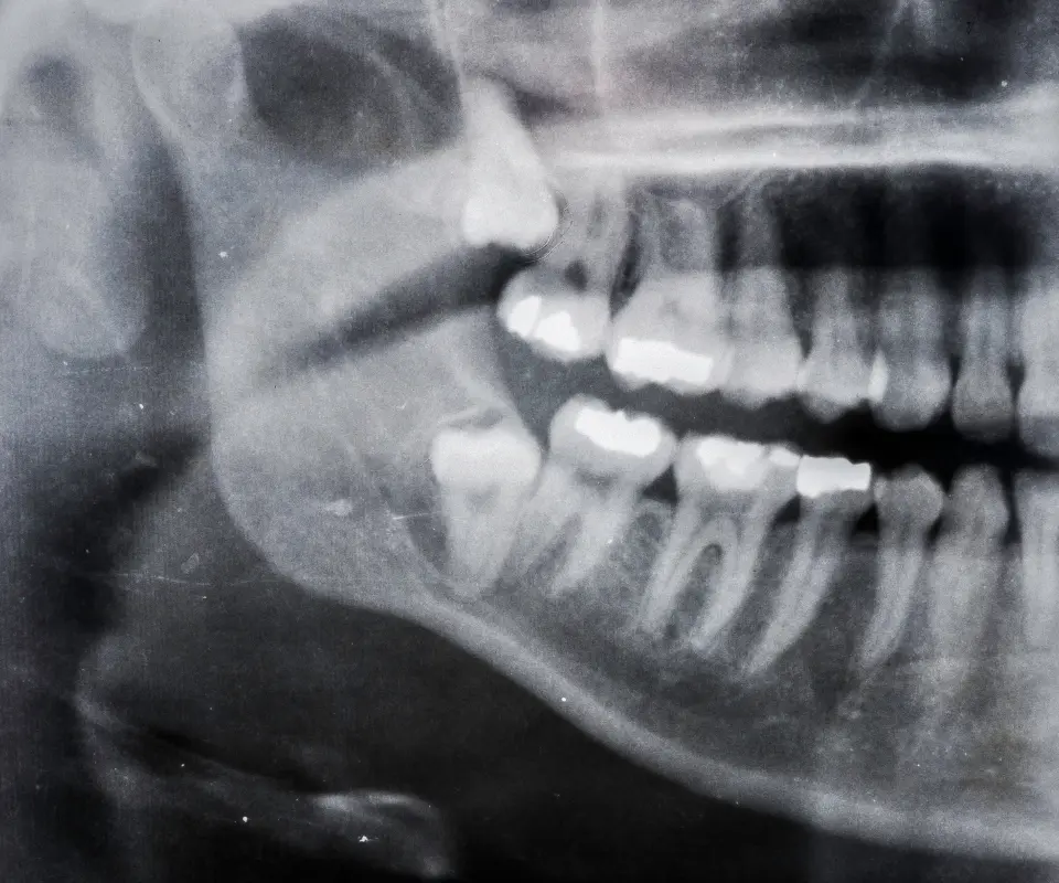 Quick Exam and Xray