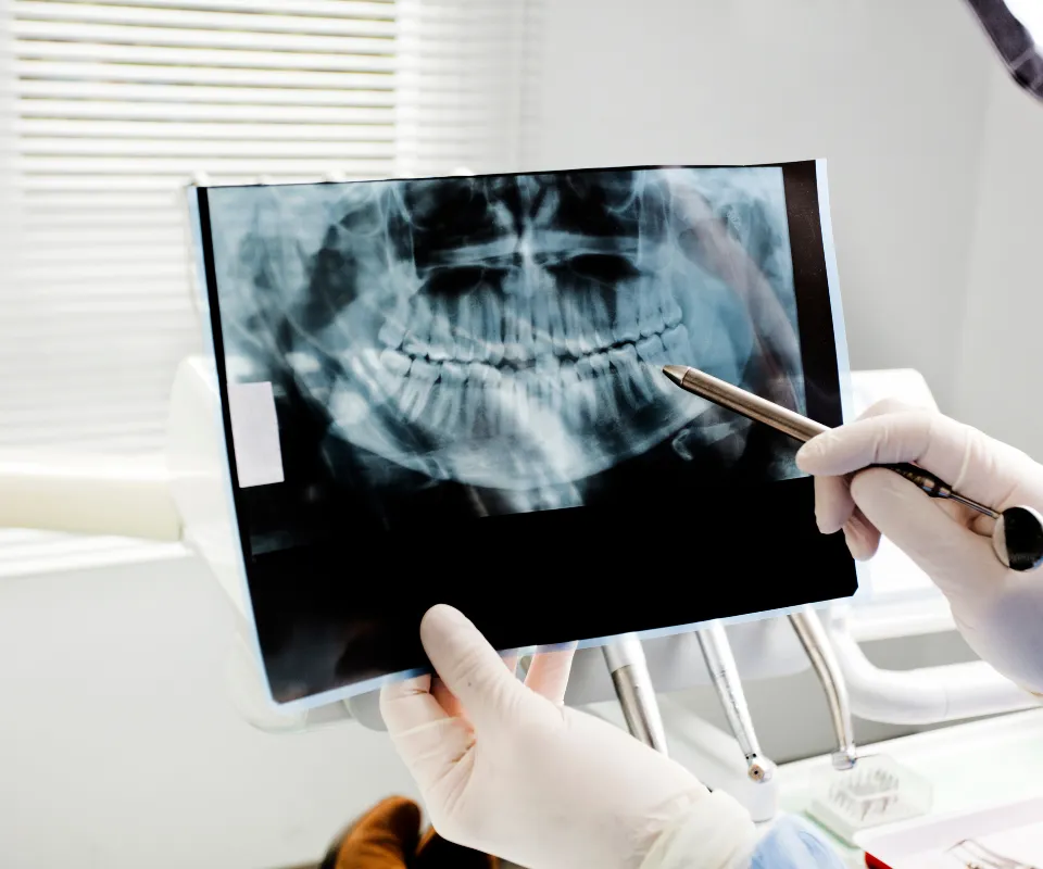 Emergency dental X-rays