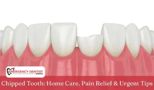 Chipped Tooth Home Care, Pain Relief & Urgent Tips