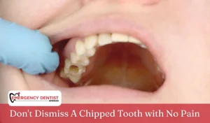 Don't Dismiss A Chipped Tooth with No Pain