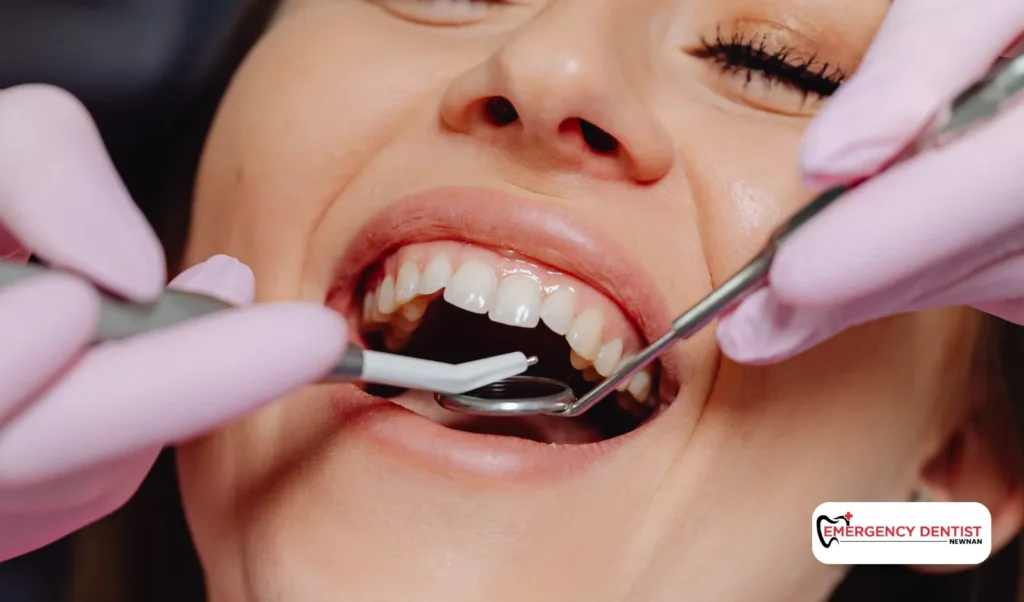 Fixing a Chipped Tooth Treatment Options