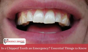 Is a Chipped Tooth an Emergency Essential Things to Know