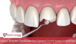 Quick, Reliable Treatment for Chipped Tooth Issues in Newnan
