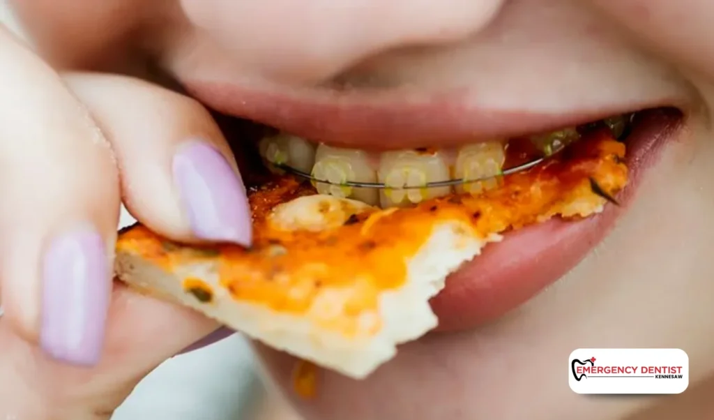 What Causes a Chipped Back Tooth Without Pain