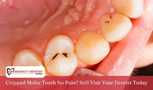 Chipped Molar Tooth No Pain Still Visit Your Dentist Today