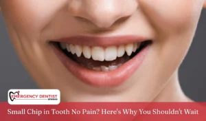 Small Chip in Tooth No Pain Here_s Why You Shouldn_t Wait