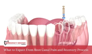 What to Expect From Root Canal Pain and Recovery Process root canal pain