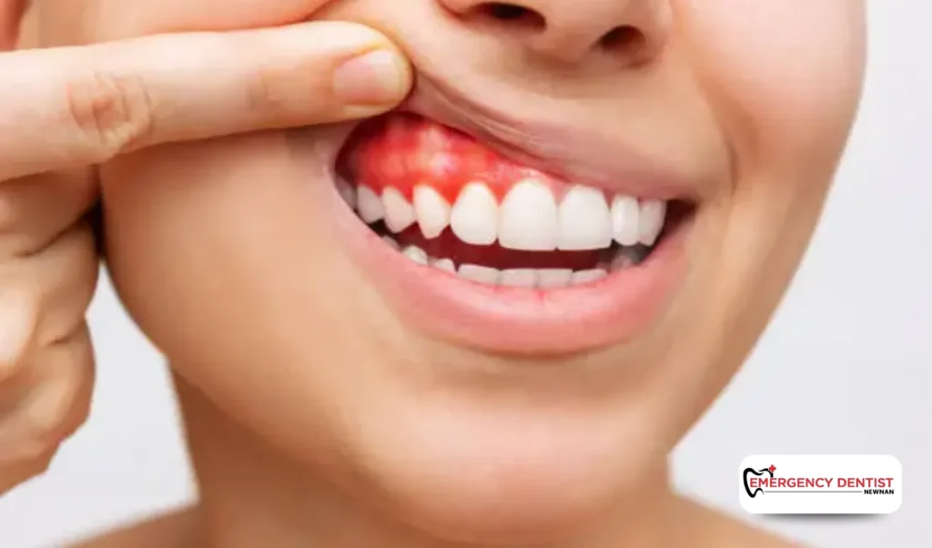 When to Contact an Emergency Dentist in Newnan, GA