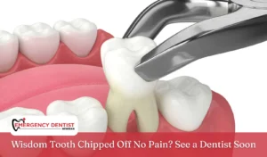 Wisdom Tooth Chipped Off No Pain See a Dentist Soon