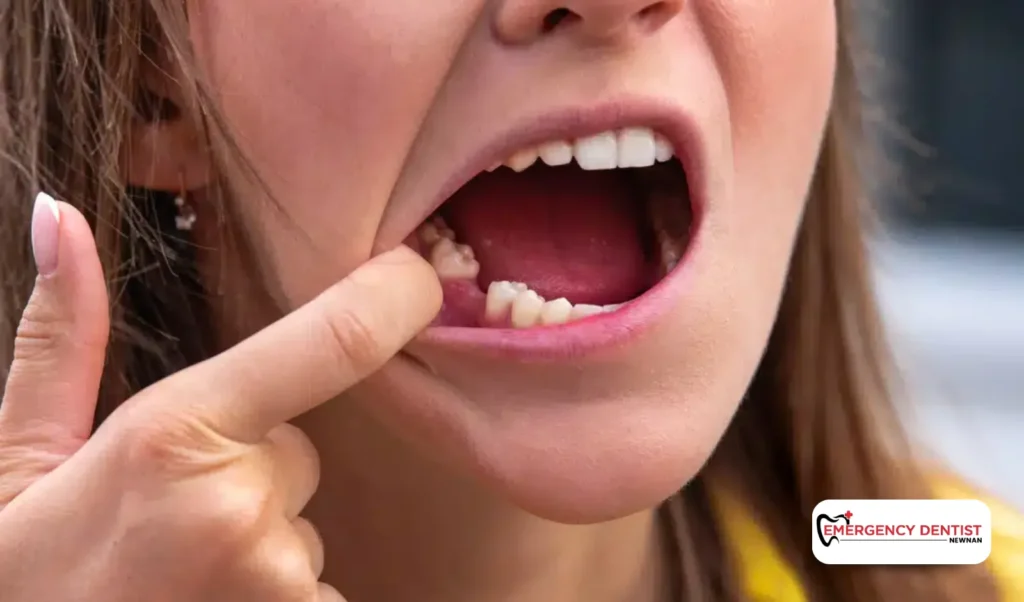 Anesthesia, Pain, and Healing After an Extraction