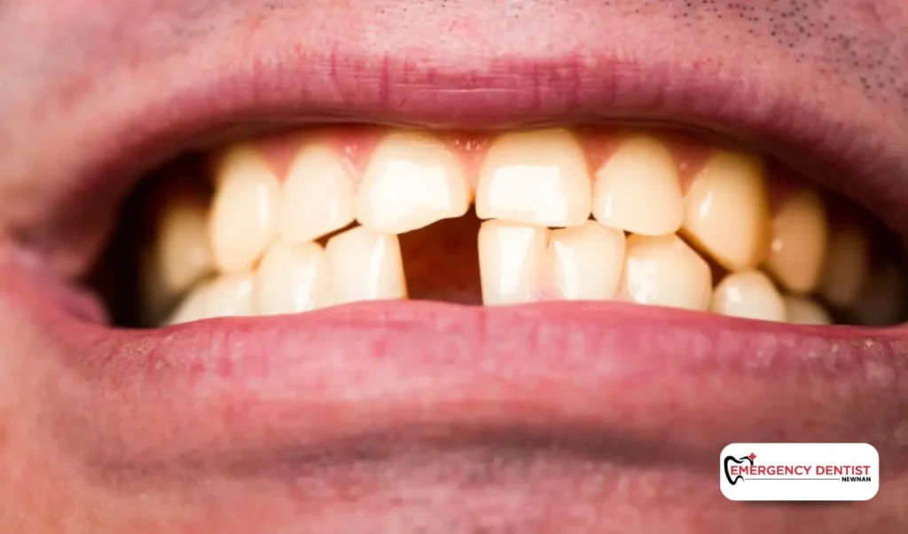 Factors That Influence the Costs of Emergency Dental Visits