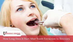How Long Does It Hurt After Tooth Extraction In Recovery