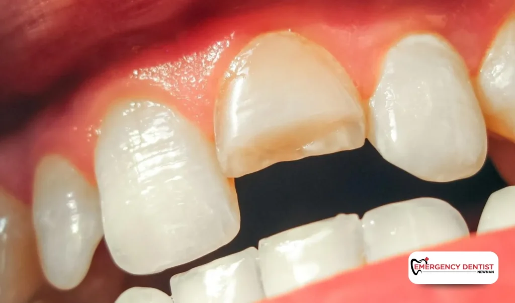 Why You May Need Emergency Dentistry