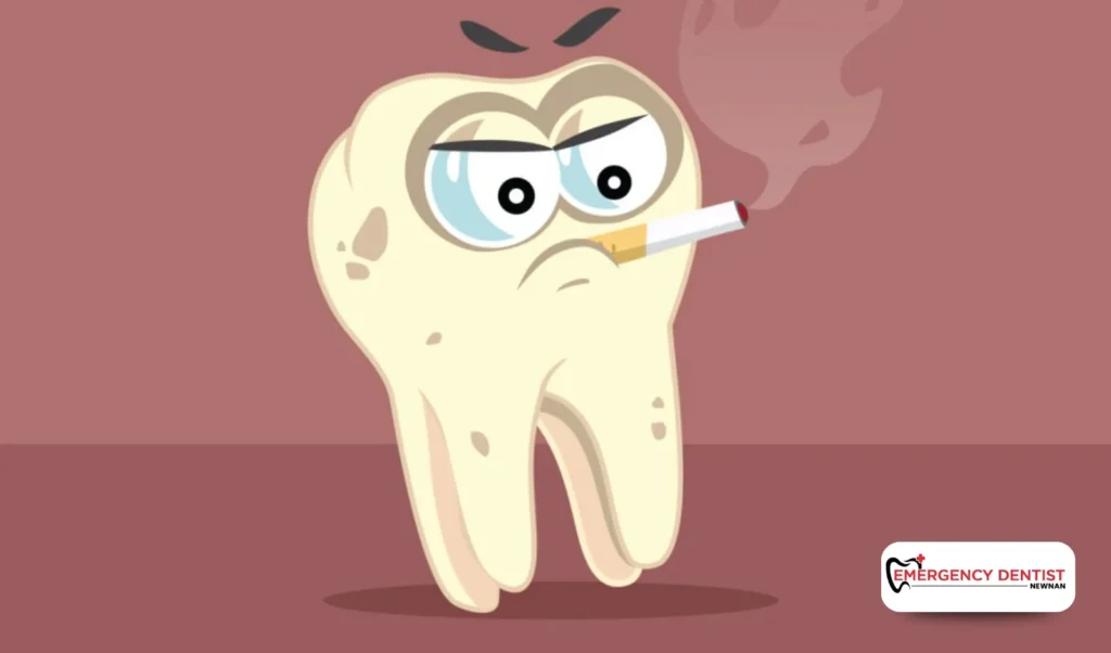 When White Gums May Signal a Problem