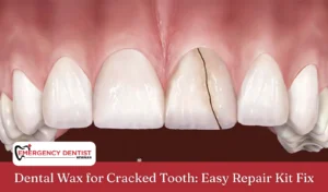 Dental Wax for Cracked Tooth Easy Repair Kit Fix