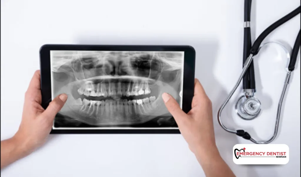 How Dentists Repair a Broken Tooth