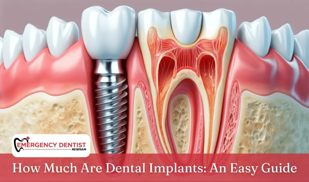 How Much Are Dental Implants An Easy Guide