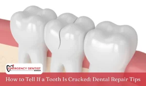 How to Tell If a Tooth Is Cracked Dental Repair Tips