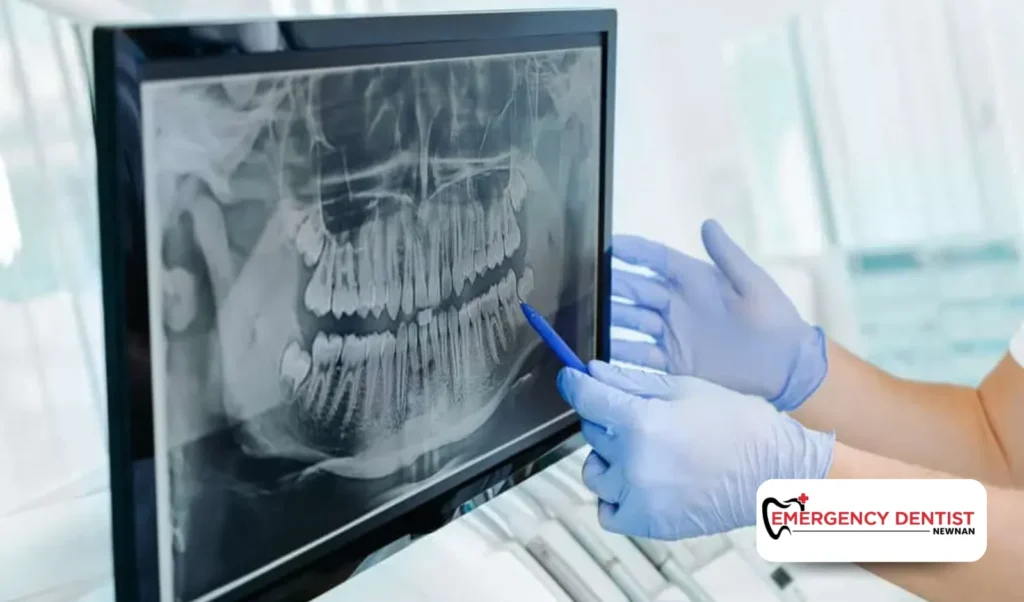 Step-by-Step Dental Implant Procedure