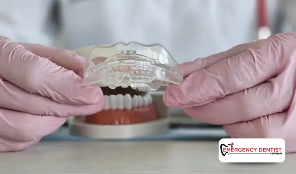 Why Custom Mouthguards Offer Better Protection