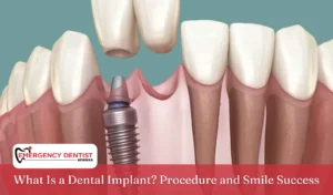 What Is a Dental Implant Procedure and Smile Success