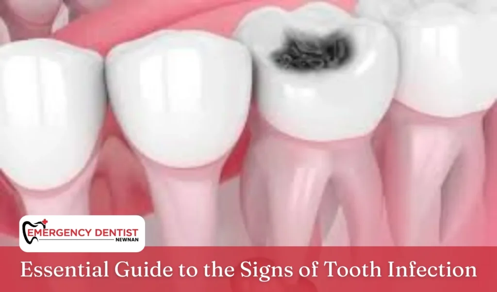 Essential Guide to the Signs of Tooth Infection