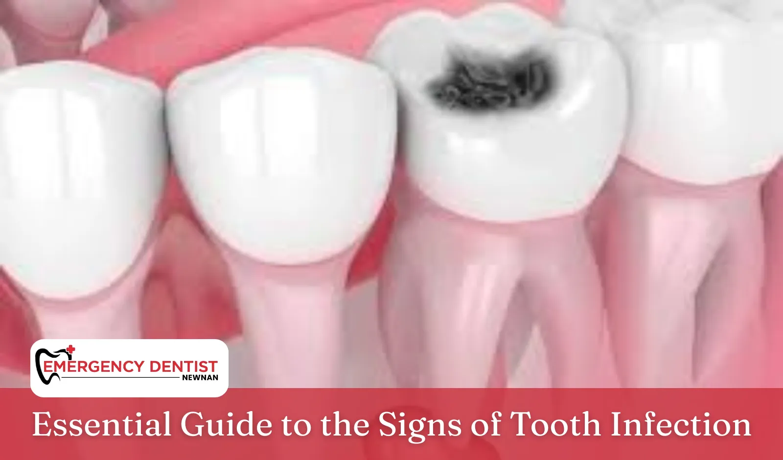 Essential Guide to the Signs of Tooth Infection