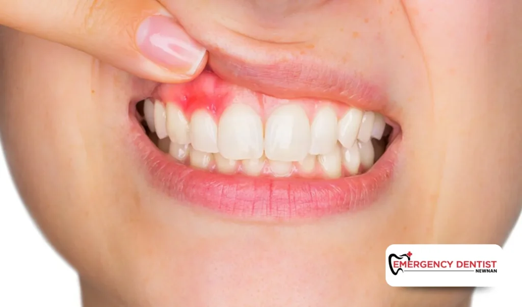 Symptoms You Might Notice