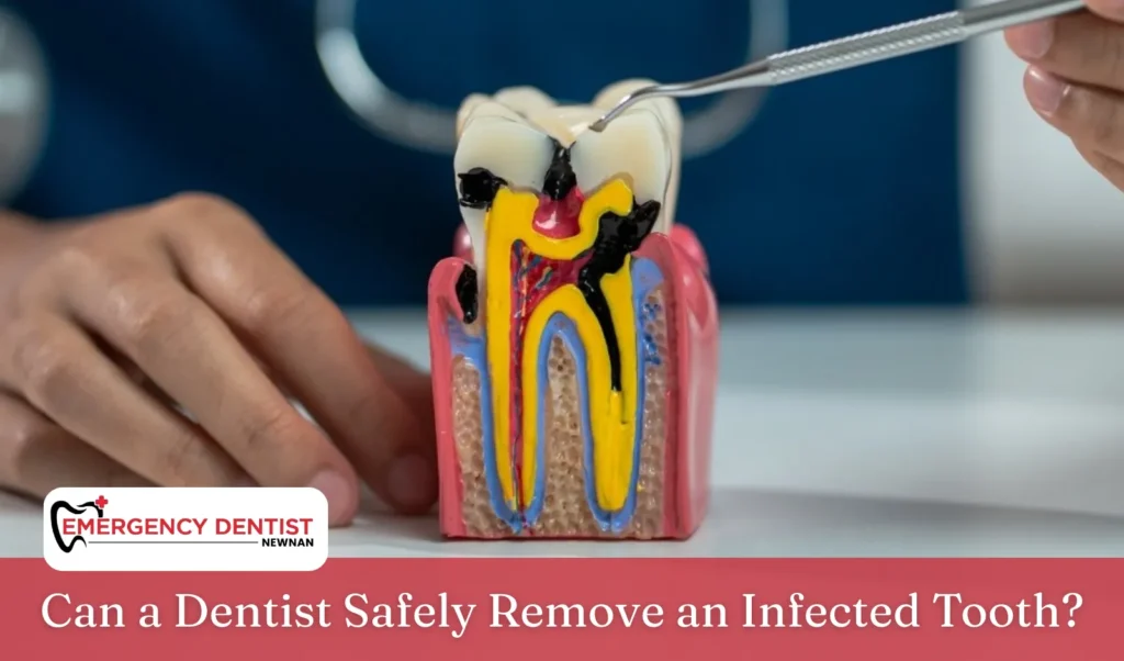 Can a Dentist Safely Remove an Infected Tooth