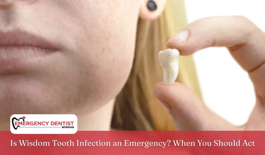 Is Wisdom Tooth Infection an Emergency When You Should Act