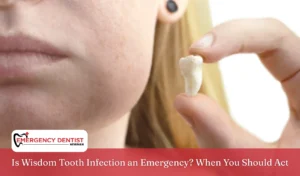 Is Wisdom Tooth Infection an Emergency When You Should Act