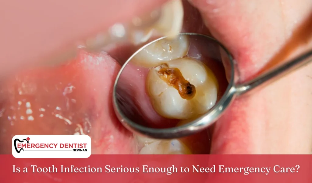 Is a Tooth Infection Serious Enough to Need Emergency Care