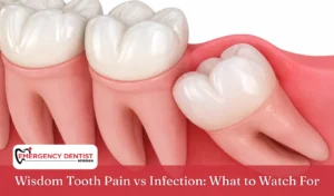 Wisdom Tooth Pain vs Infection What to Watch For