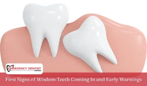 First Signs of Wisdom Teeth Coming In and Early Warnings