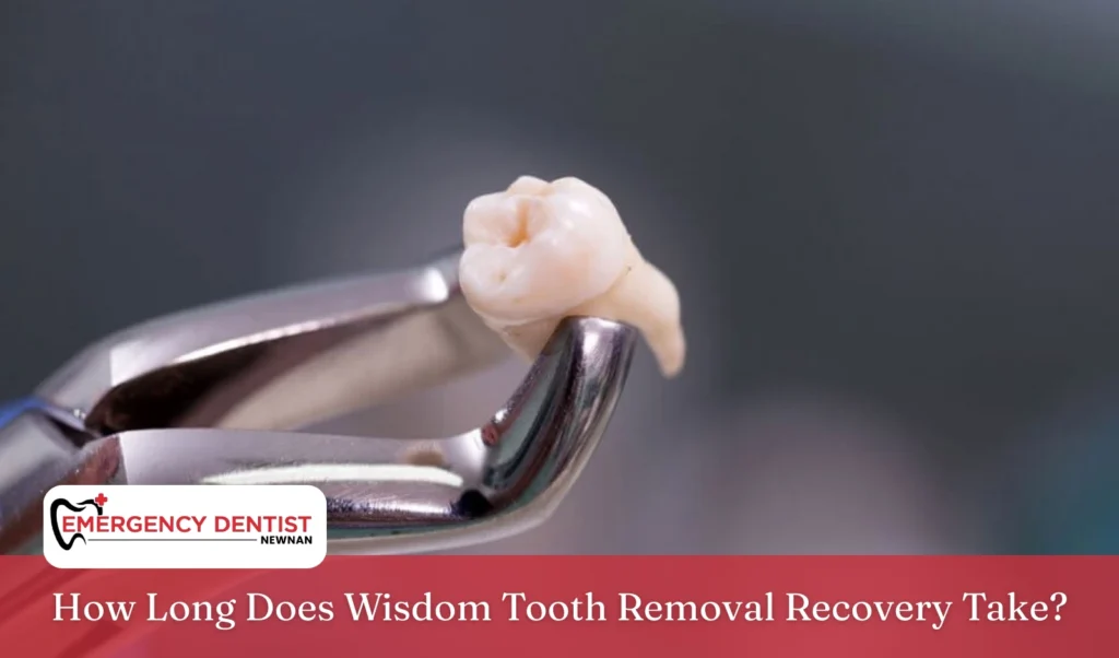 How Long Does Wisdom Tooth Removal Recovery Take