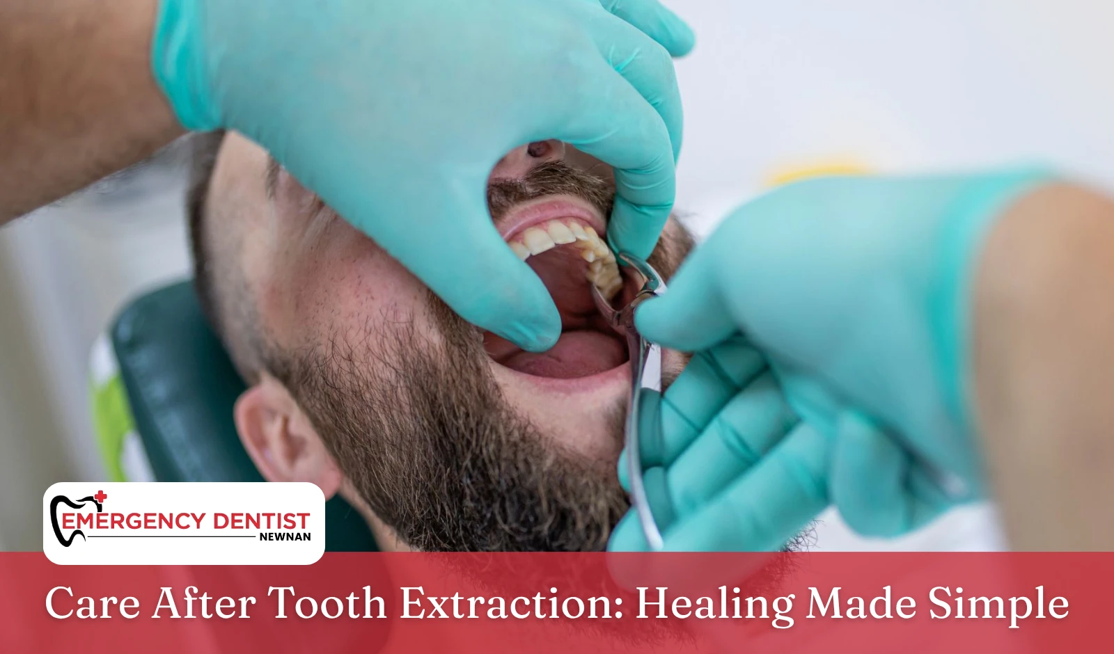 care-after-tooth-extraction-guide