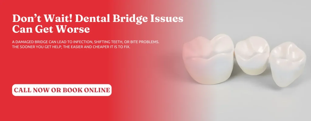 Dental-Bridge-Issues-Repair-Newnan-GA