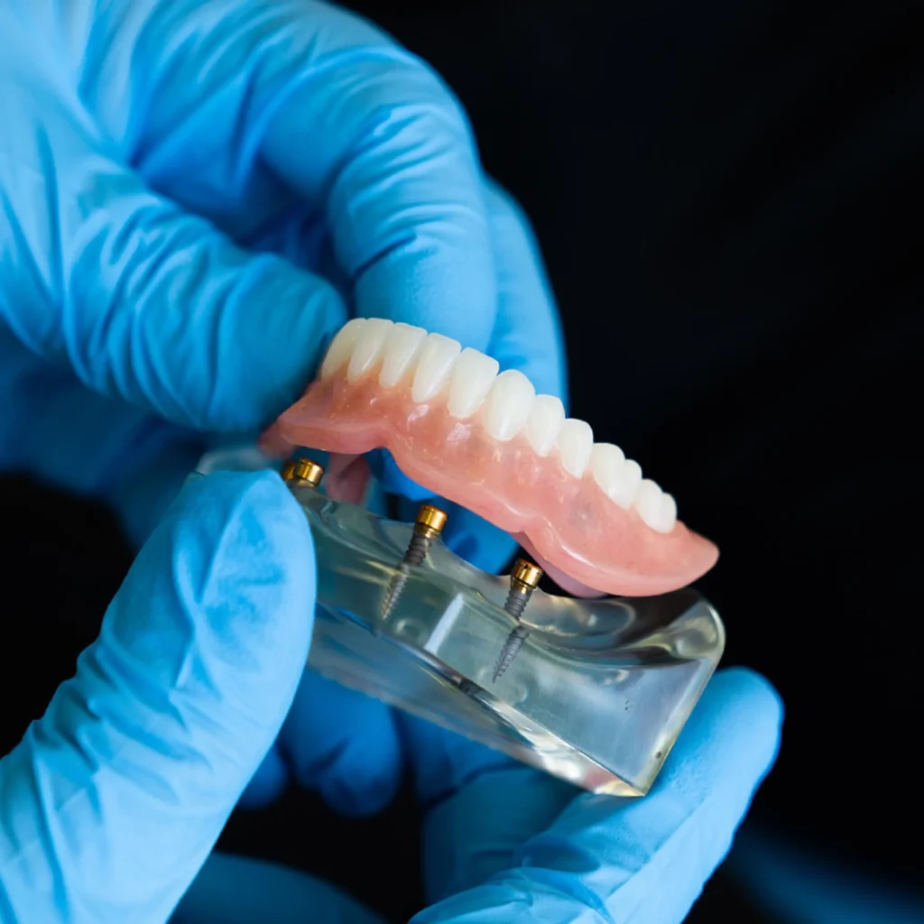 Emergency-Denture-Repair-Newnan-GA