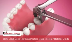 how-long-tooth-extraction-heal-helpful-guide