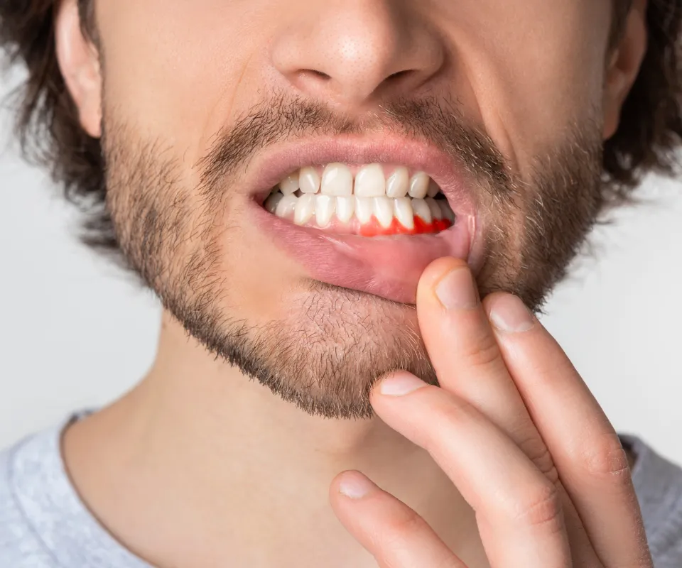 When-to-See-an-Emergency-Dentist-for-a-Tooth-Infection-Newnan-GA