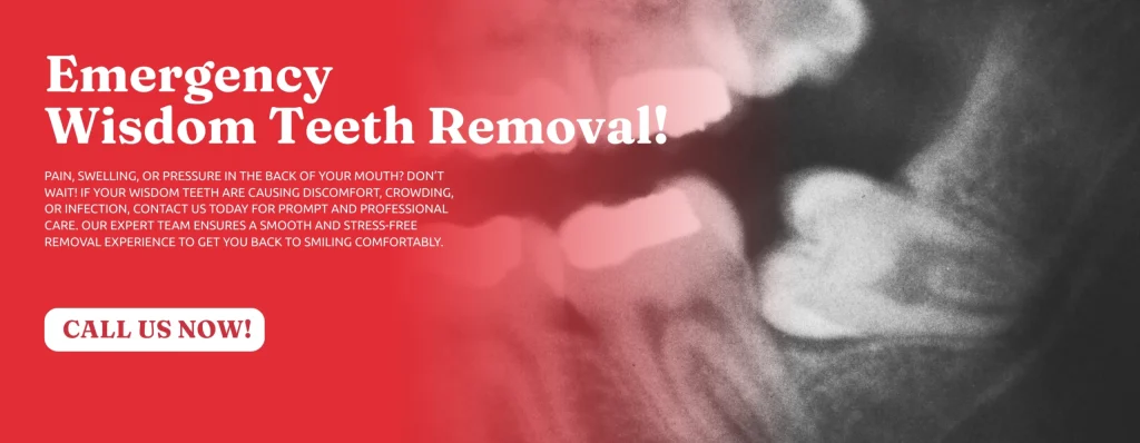 Book-Wisdom-Teeth-Removal-Newnan-GA