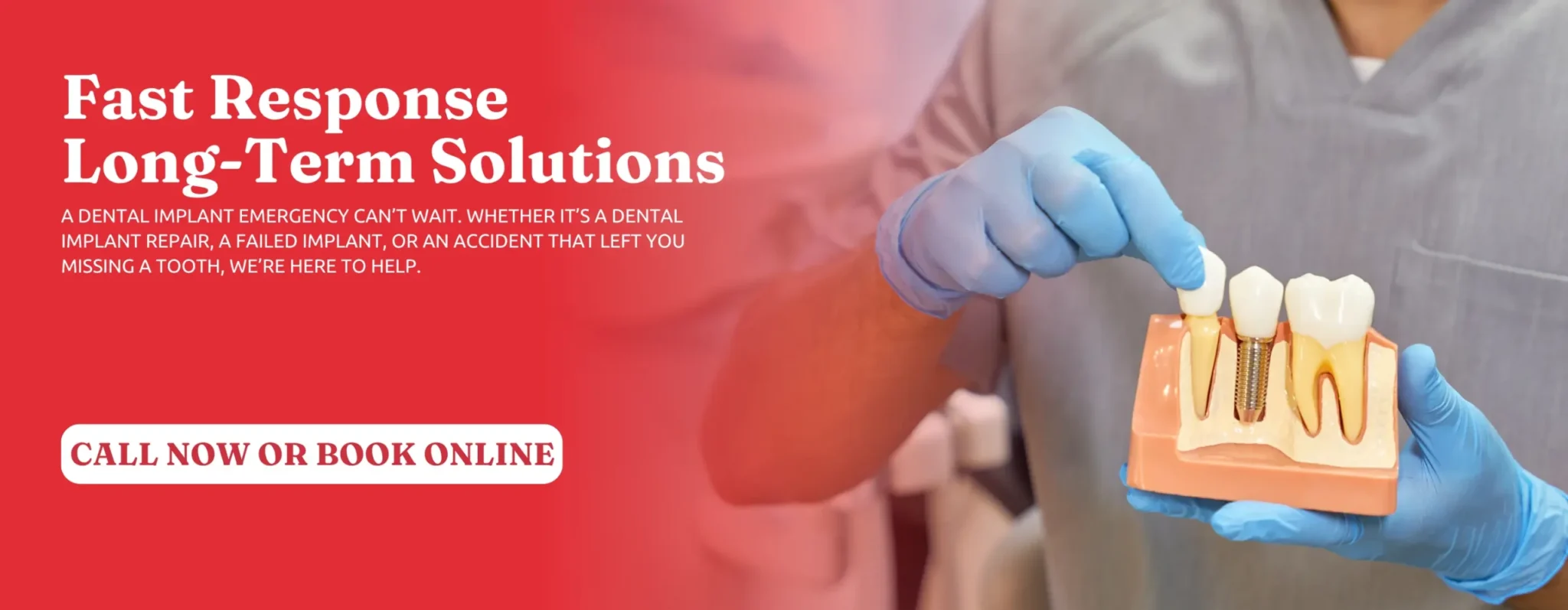 Dental-Implant-Solutions-in-Newnan-GA