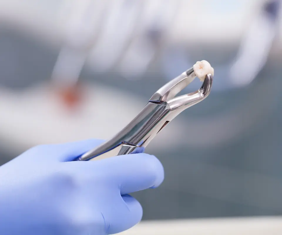 Emergency-Extraction-Newnan-GA