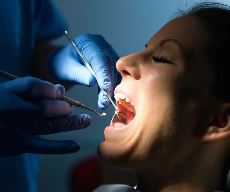Lost-Fillings-or-Crowns-Newnan-GA