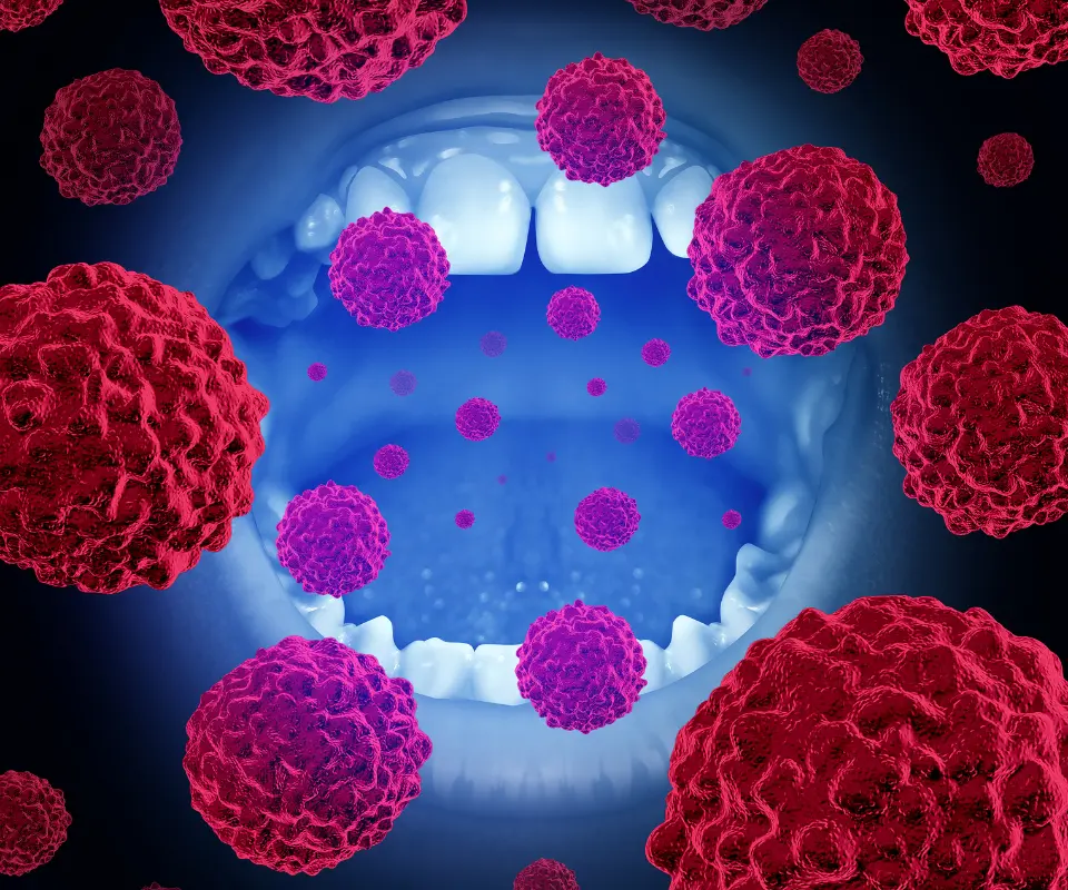 Oral-Cancer-Newnan-GA