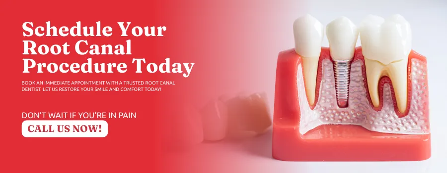 Schedule-Root-Canal-Procedure-in-Newnan-GA