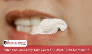 when-to-safely-take-gauze-out-extraction