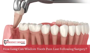 how-long-wisdom-tooth-pain-lasts-after-surgery